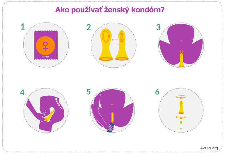 Ako používať ženský kondóm návod